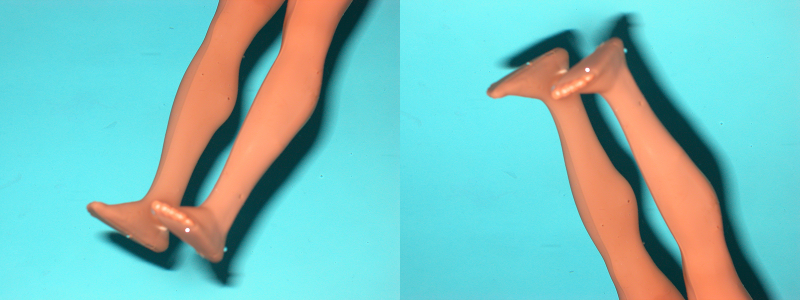 Illustration for article titled DIY Prosthetics: The Extreme Athlete Who Built a New Knee
